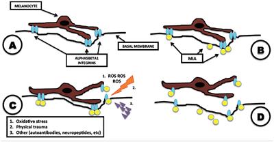 Melanoma Inhibitory Activity (MIA) Is Able to Induce Vitiligo-Like Depigmentation in an in vivo Mouse Model by Direct Injection in the Tail